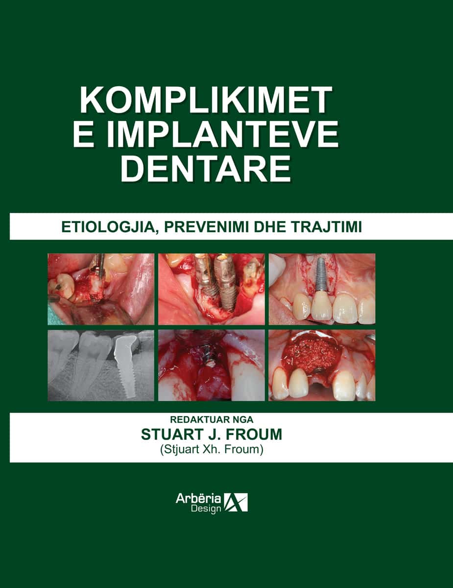 КОМПЛИКАЦИИ КАЈ ЗАБНИТЕ ИМПЛАНТИ